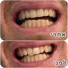 מרפאת שיניים Oshen