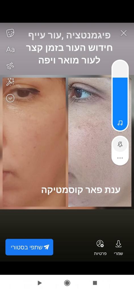 ענת פאר קוסמטיקה מתקדמת ענת פאר קוסמטיקה מתקדמת