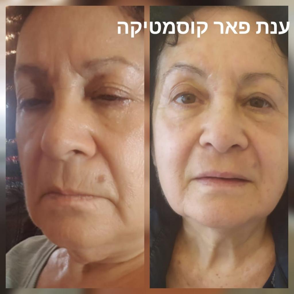 ענת פאר קוסמטיקה מתקדמת ענת פאר קוסמטיקה מתקדמת