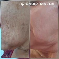 ענת פאר קוסמטיקה מתקדמת