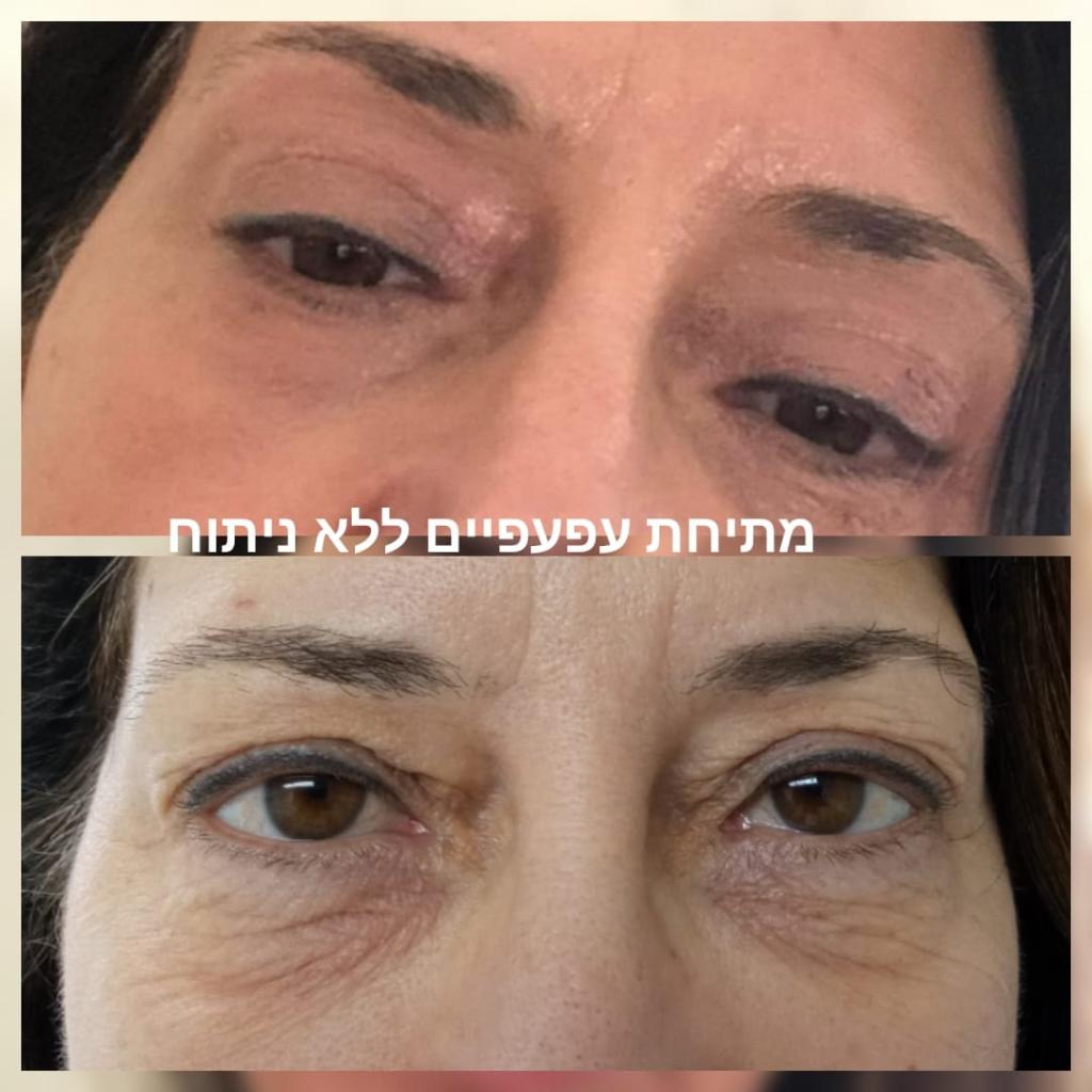 ענת פאר קוסמטיקה מתקדמת ענת פאר קוסמטיקה מתקדמת