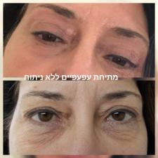 ענת פאר קוסמטיקה מתקדמת