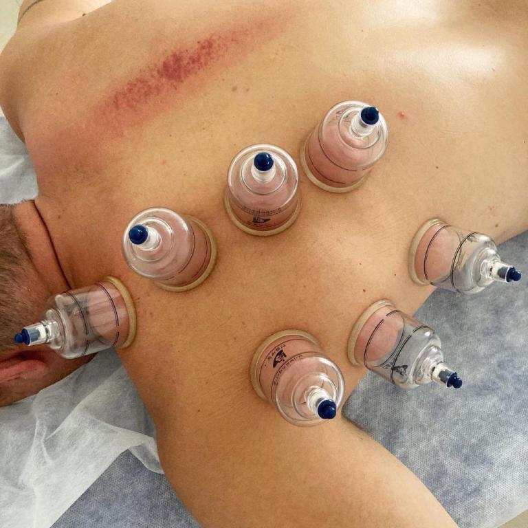 רון בן בכר רון בן בכר