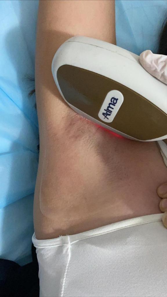 אופל אסתטיק אופל אסתטיק