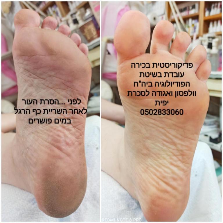 יפית טיפוח רגליים יפית טיפוח רגליים