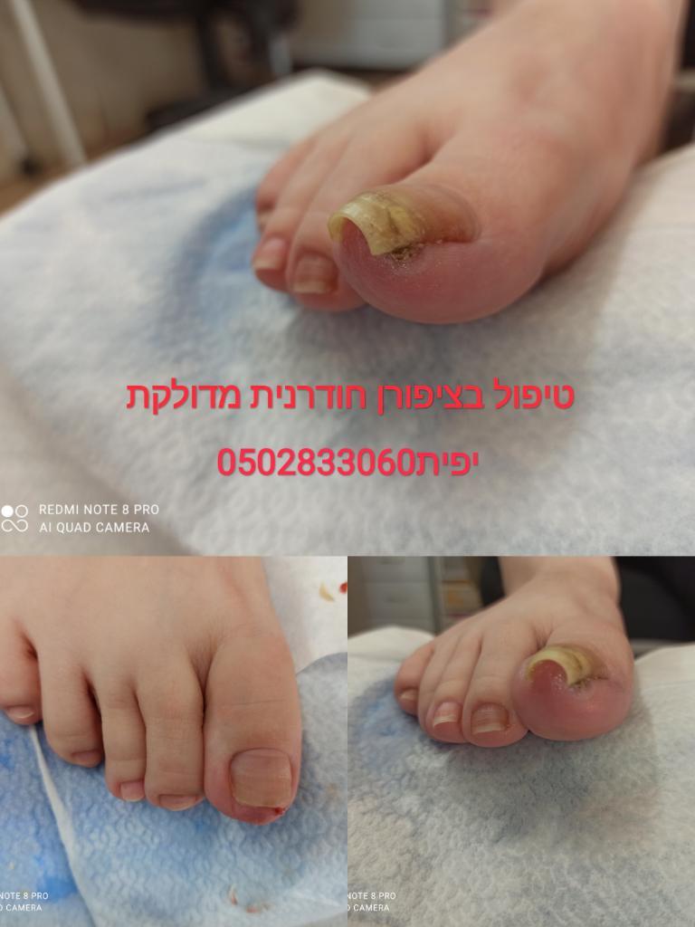 יפית טיפוח רגליים יפית טיפוח רגליים