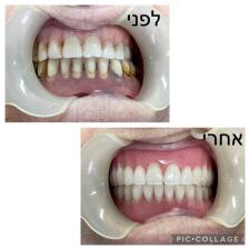 ד"ר נתנאל גולדשטיין