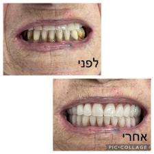 ד"ר נתנאל גולדשטיין