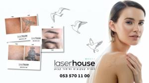 laser house