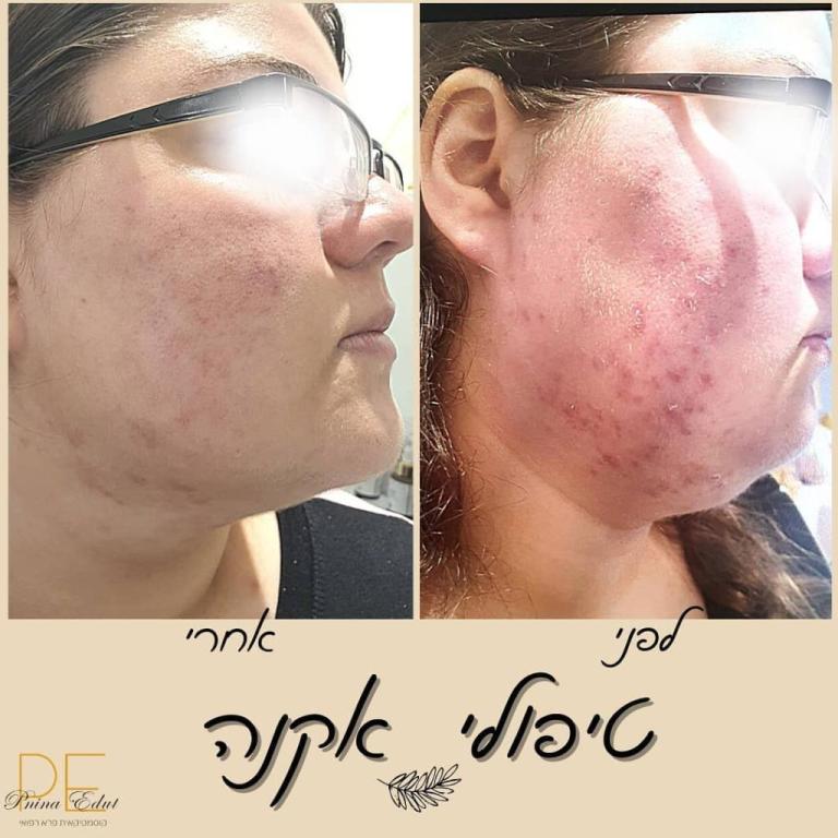 פנינה עדות פנינה עדות