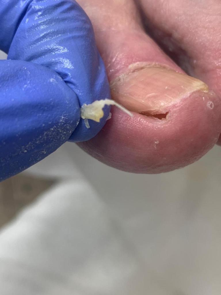 מורייל מורייל