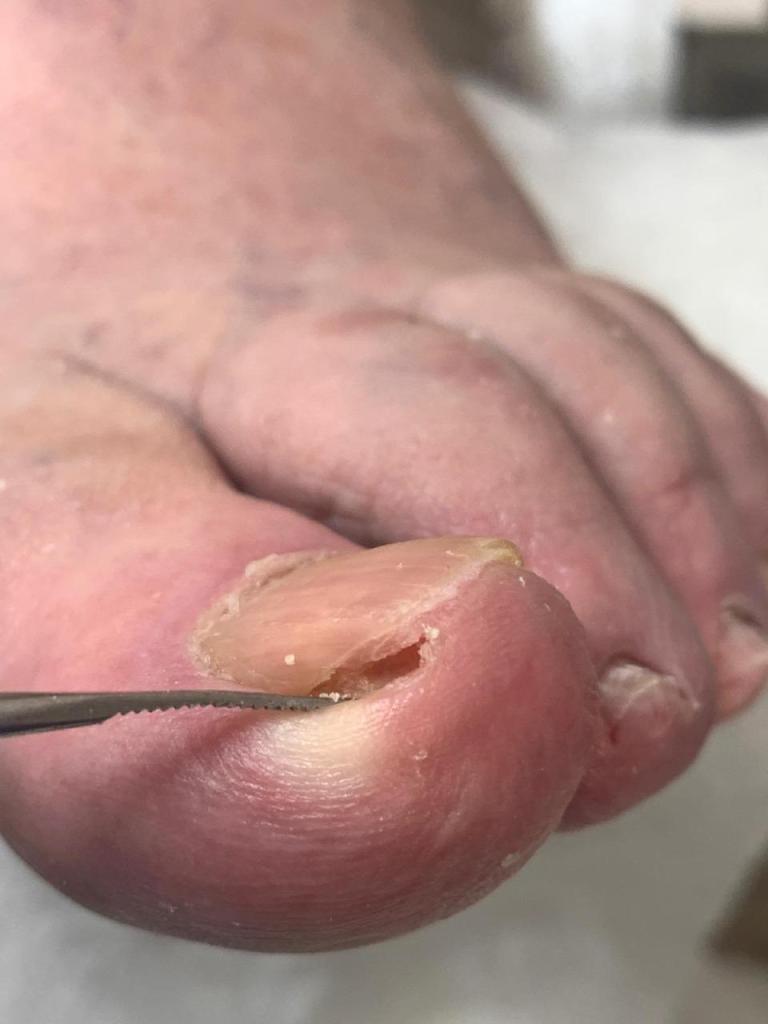 מורייל מורייל