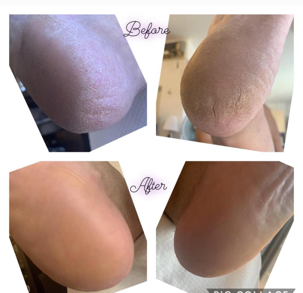 Liraz ILO Zadok Liraz ILO Zadok