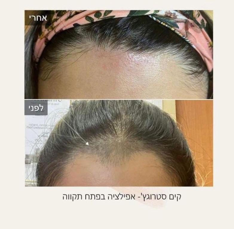 קים סטרוגץ קים סטרוגץ