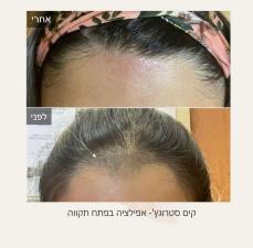 קים סטרוגץ