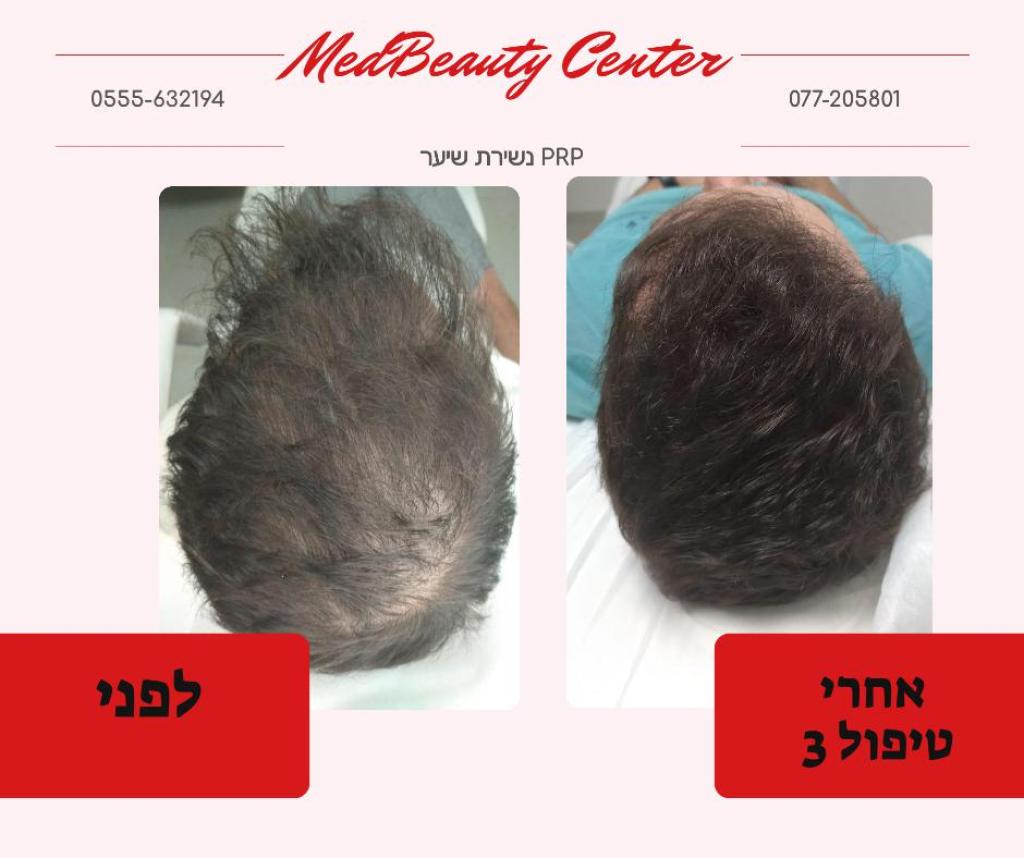 מידביוטי סנטר מידביוטי סנטר