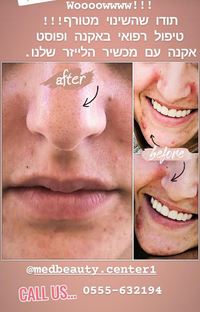 מידביוטי סנטר מידביוטי סנטר