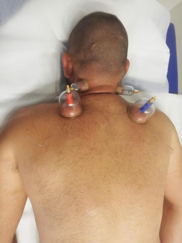 יוחאי רינון יוחאי רינון