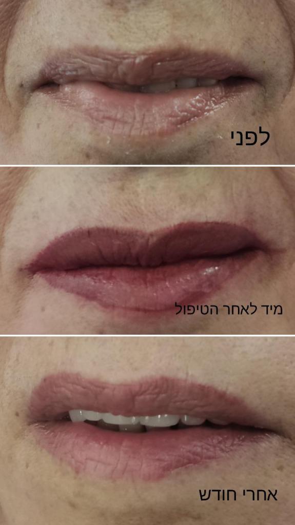 Sharonepill Sharonepill