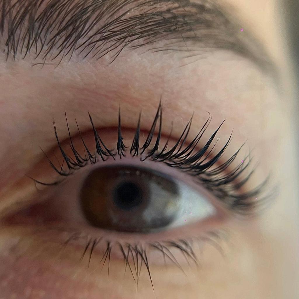 לוטם אוחיון לוטם אוחיון