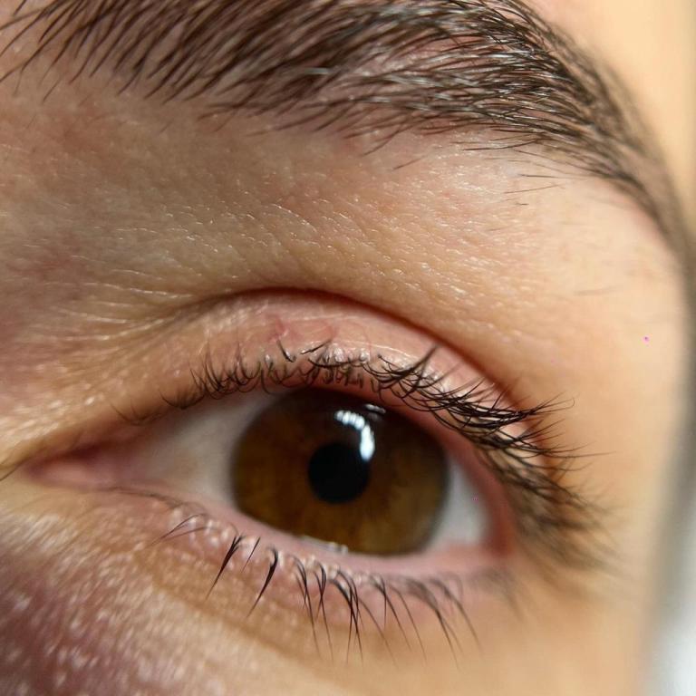 לוטם אוחיון לוטם אוחיון