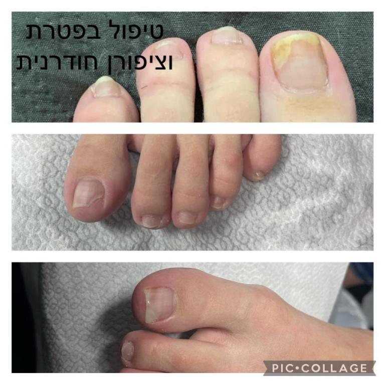 אסנת ביו סקלפצר אסנת ביו סקלפצר