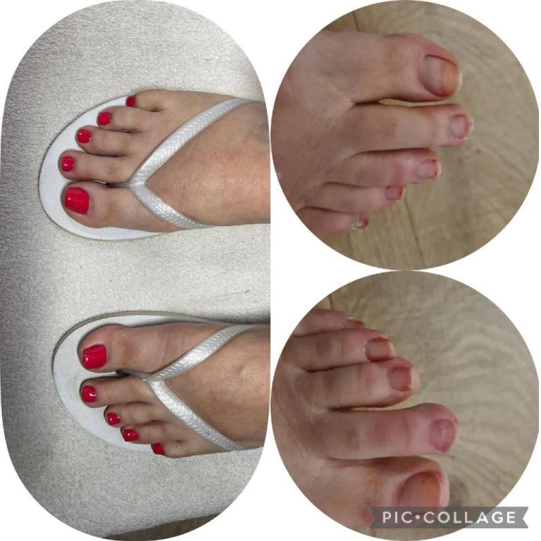 אסנת ביו סקלפצר אסנת ביו סקלפצר