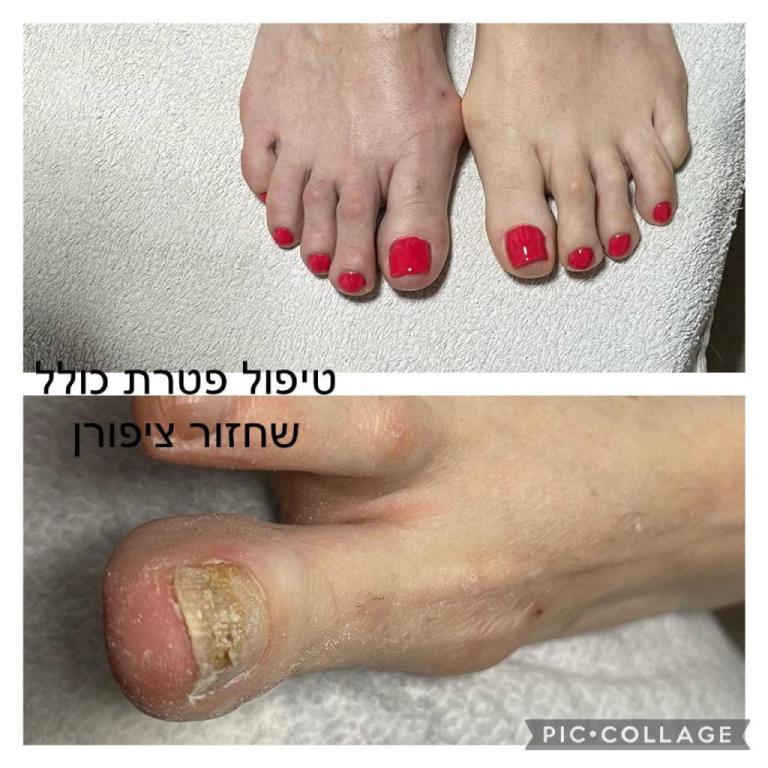 אסנת ביו סקלפצר אסנת ביו סקלפצר