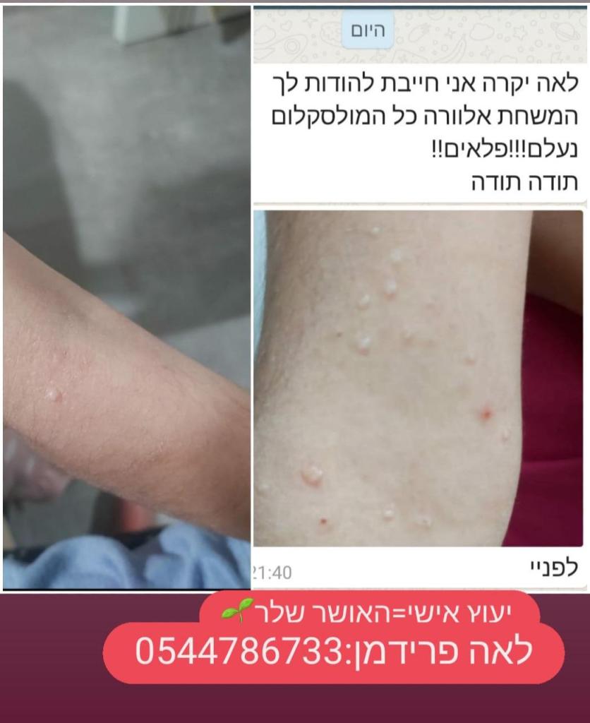 לאה פוראוור לאה פוראוור