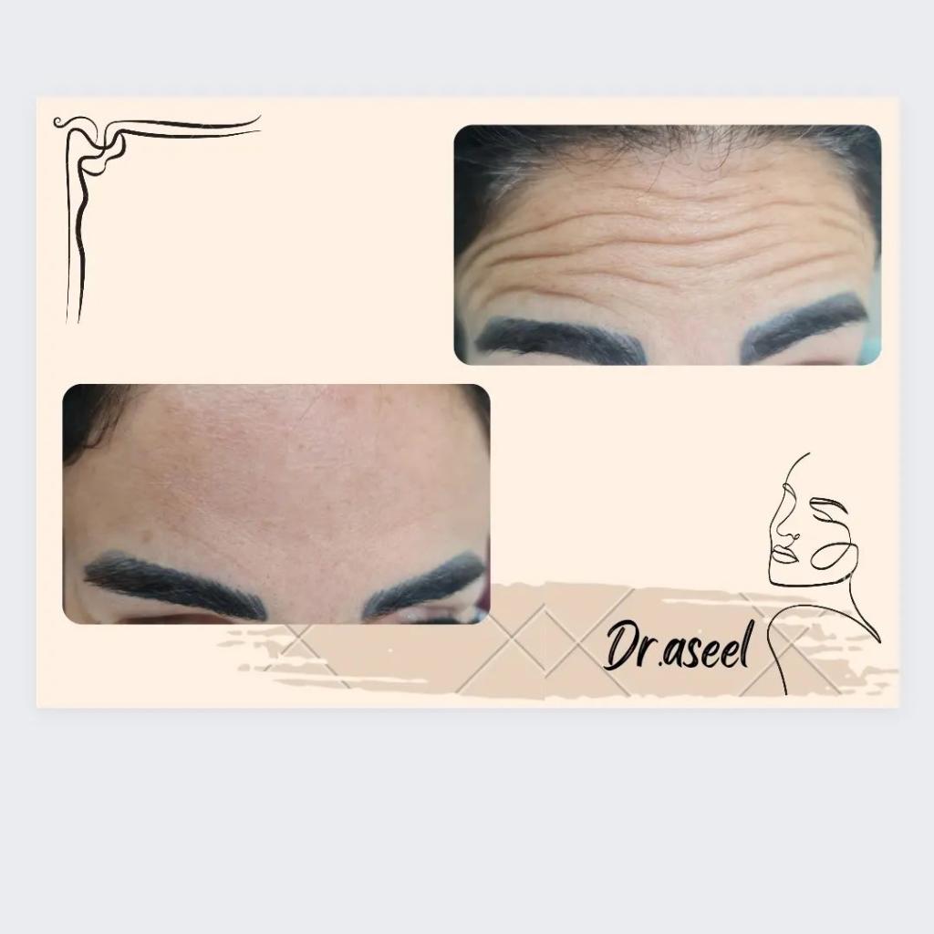 מידידנט מידידנט