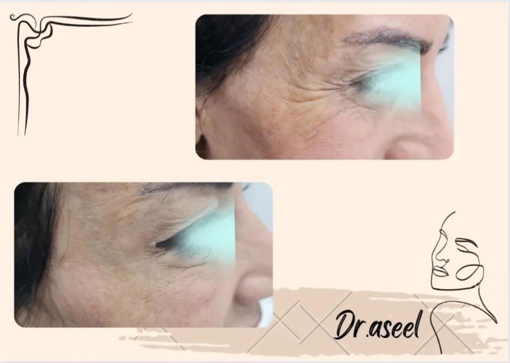 מידידנט מידידנט