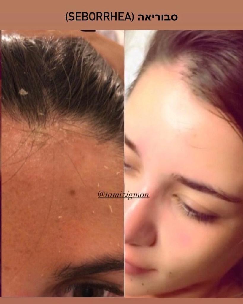 תמי זיגמון תמי זיגמון