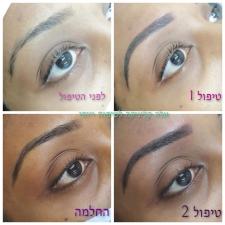 אלה קליניקה לטיפוח ויופי