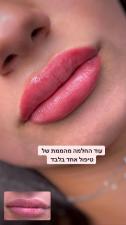 Meytal Lips