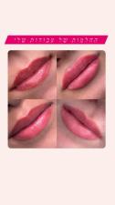 Meytal Lips