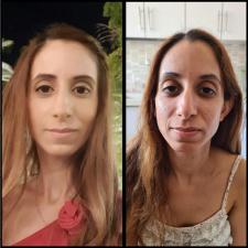 מיטל גולדרינג