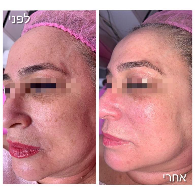 מרינה יוגב מרינה יוגב