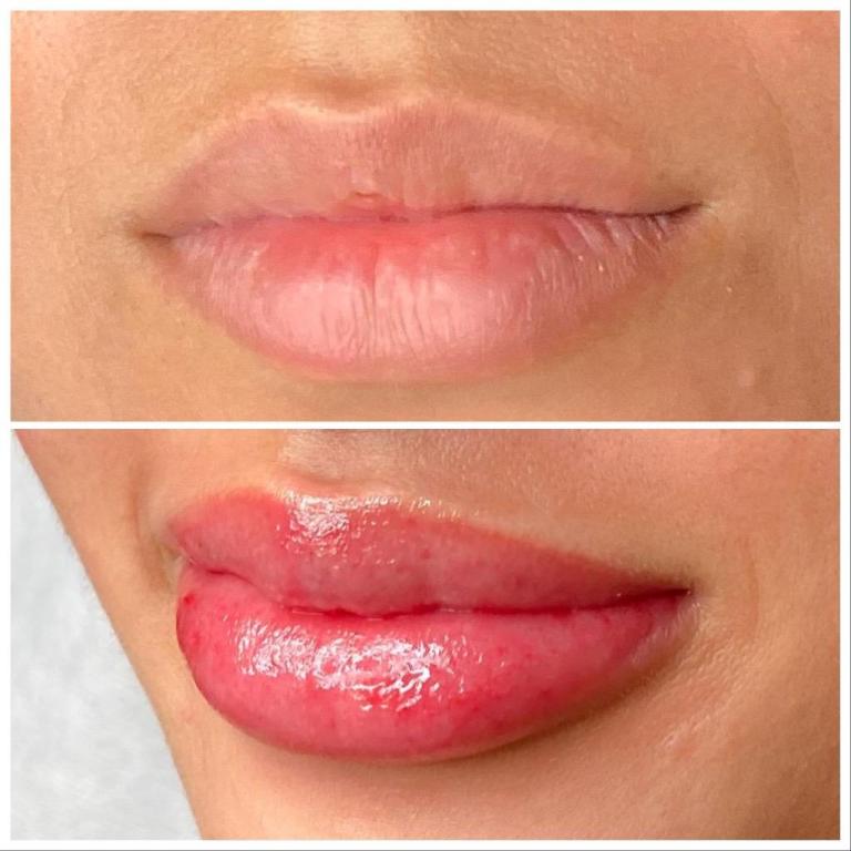 גליפס Galips גליפס Galips