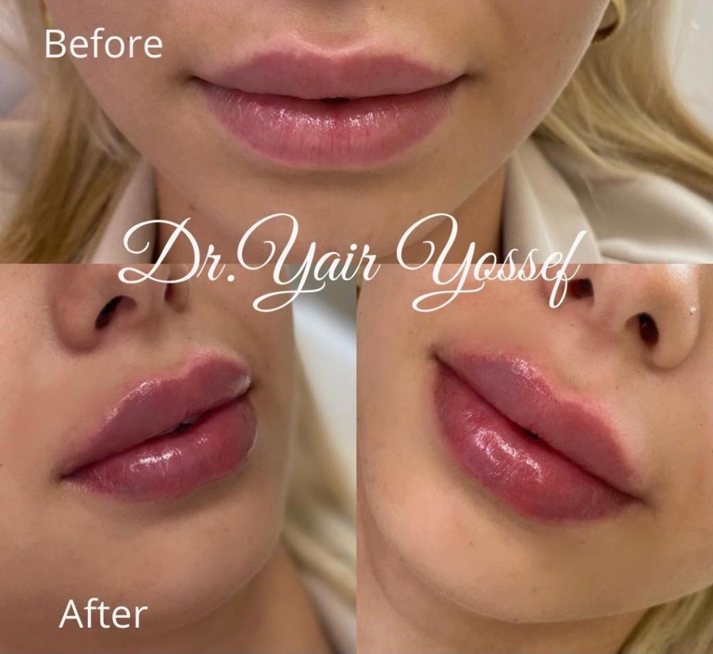 ד"ר יאיר יוסף ד"ר יאיר יוסף