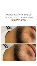 יהודית JP face clinic