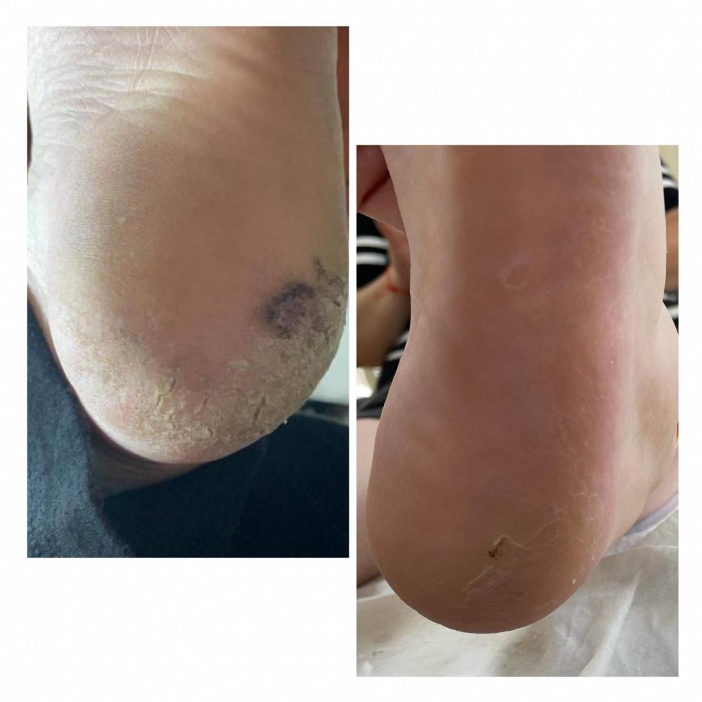 Hadar nails Hadar nails