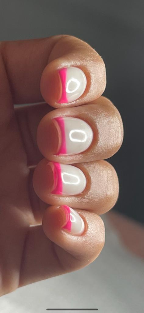 אנאל ביוטי אנאל ביוטי