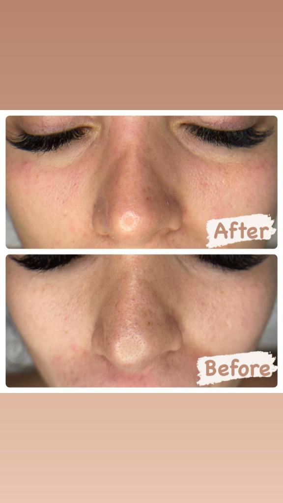 חן ספר קוסמטיקה מתקדמת חן ספר קוסמטיקה מתקדמת