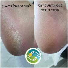 סגלית פרדס