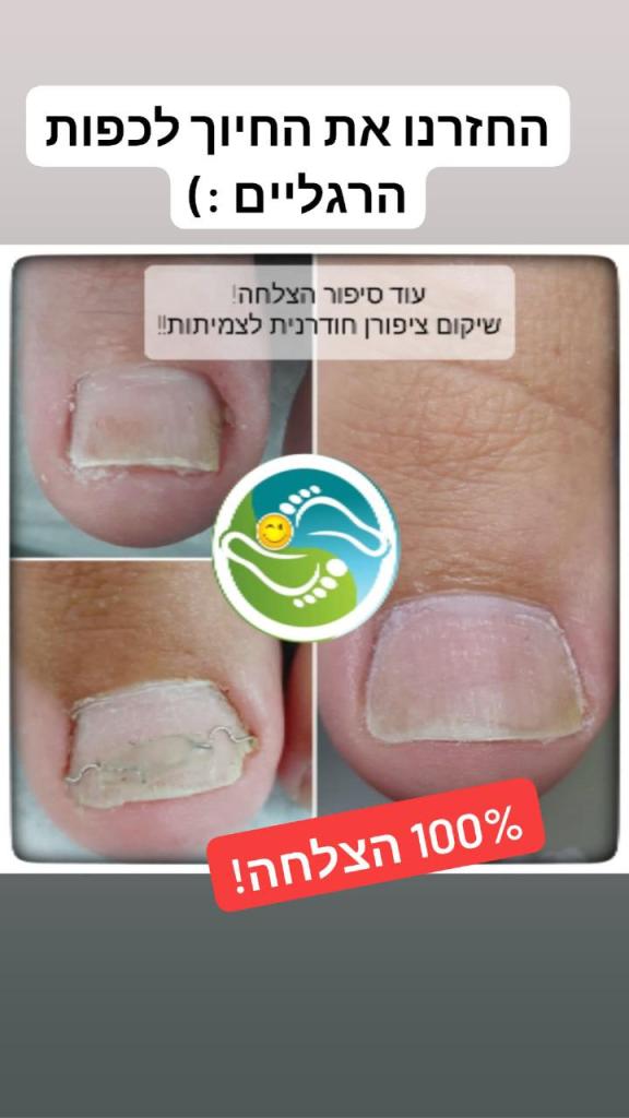 סגלית פרדס סגלית פרדס