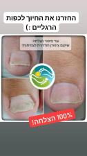 סגלית פרדס