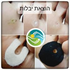 סגלית פרדס