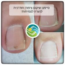 סגלית פרדס