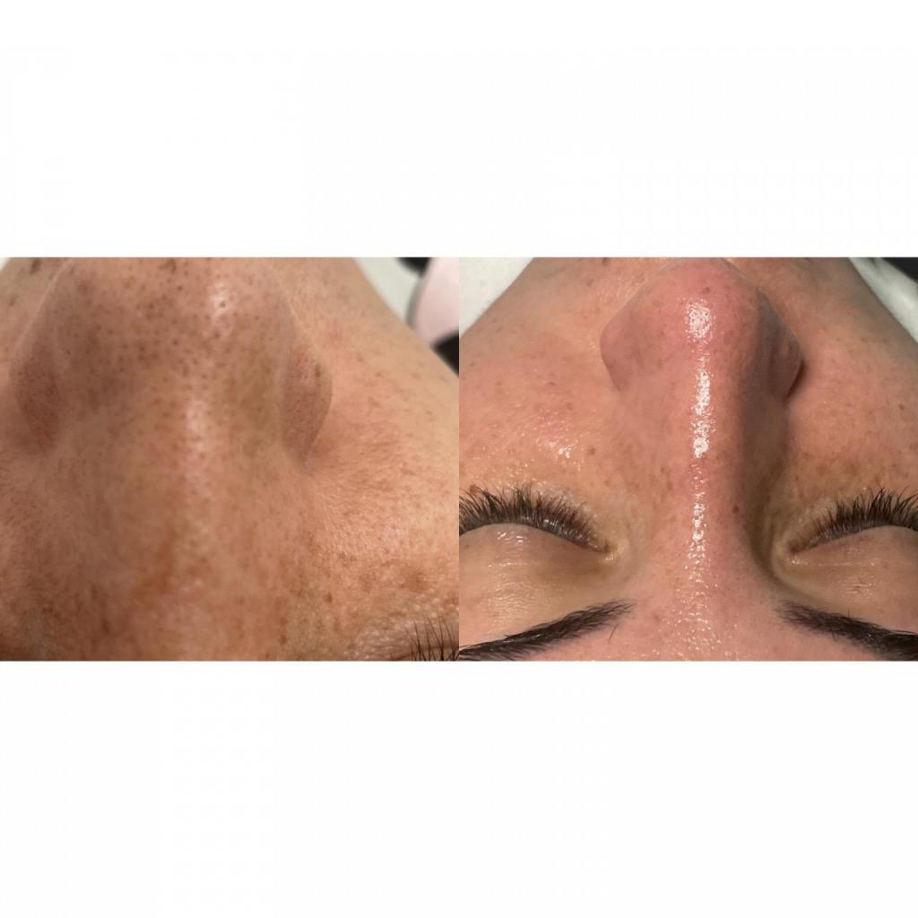 קרן קוסמטיקה קרן קוסמטיקה