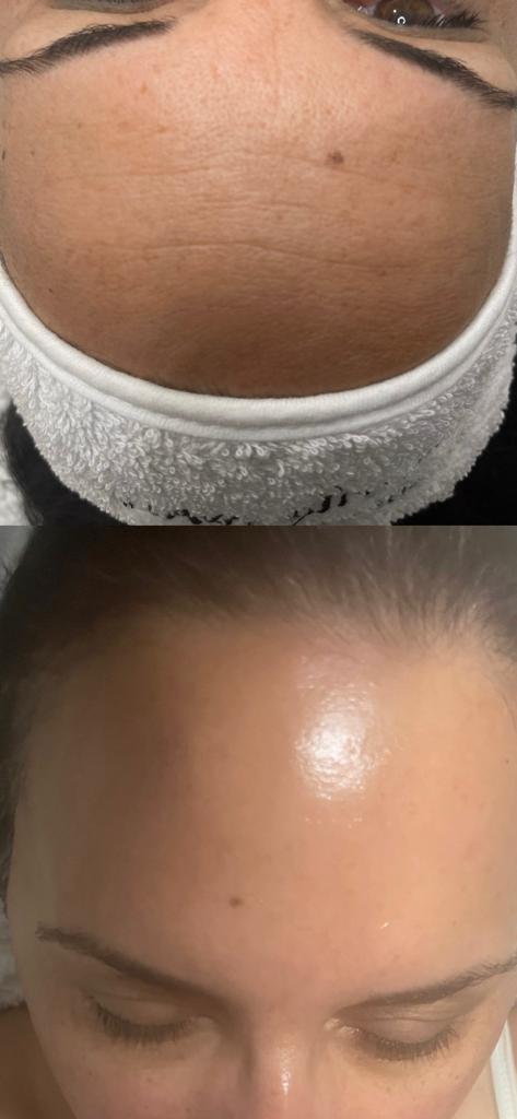 קרן קוסמטיקה קרן קוסמטיקה